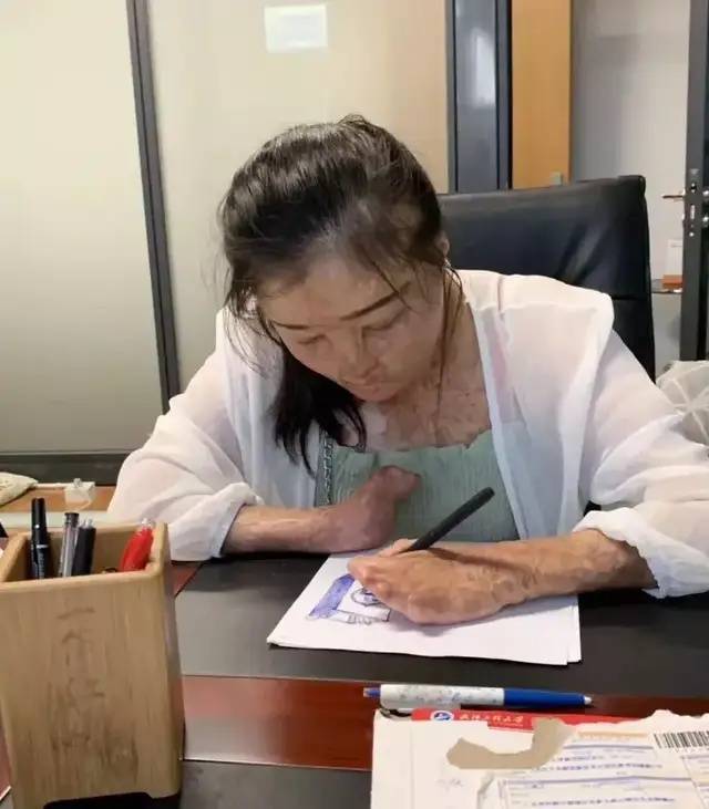 皇冠皇冠代理平台
_全身95%烧伤女孩订婚了皇冠皇冠代理平台
，与未婚夫同年同月同日生，本人发声：请大家祝福我们吧